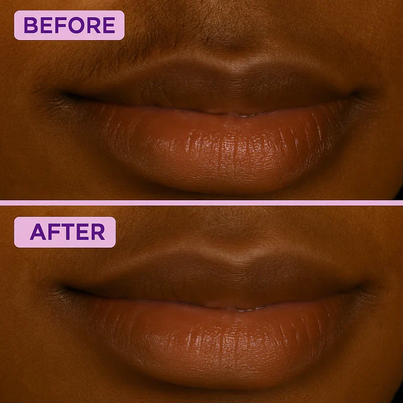 Before and after result
